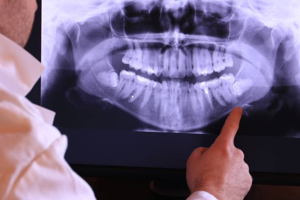 Best 24-Hour Emergency Dental Care in Port Townsend, WA
